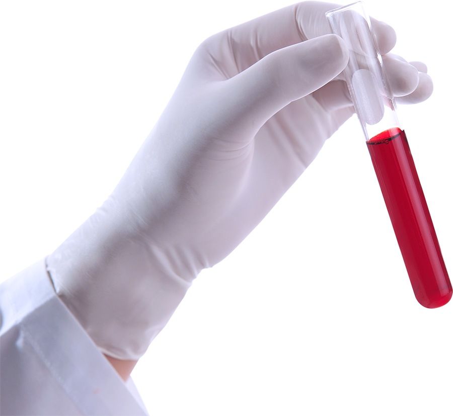 STI testing